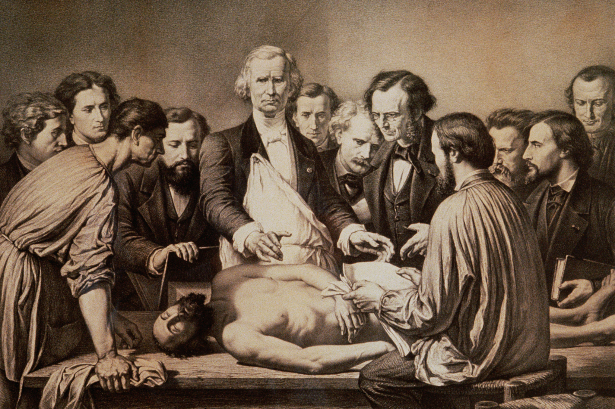 A 19th century anatomy lesson